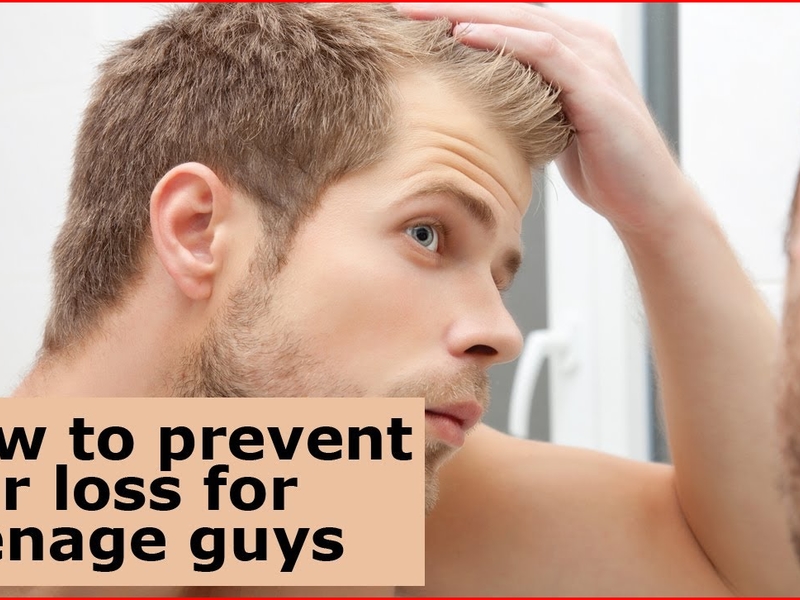 Prefect Does Balding Stop Hair Fall for Short Hair